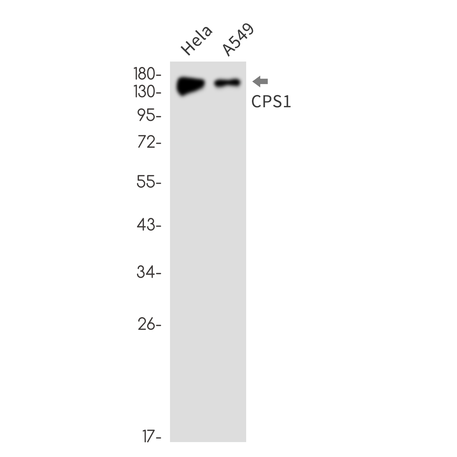 CPS1 Rabbit mAb